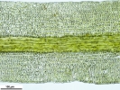 Rhabdoweisia crispata