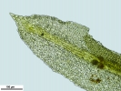 Rhabdoweisia crispata
