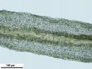 Cnestrum alpestre