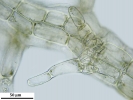 Telaranea nematodes