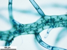 Telaranea nematodes