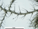 Telaranea nematodes