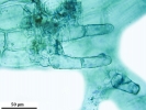 Telaranea nematodes