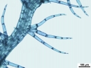 Telaranea nematodes
