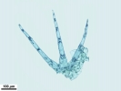 Telaranea nematodes