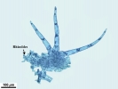 Telaranea nematodes