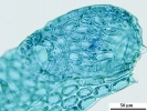 Drepanolejeunea anoplantha