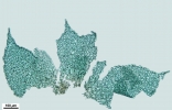Drepanolejeunea anoplantha