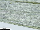 Homalothecium philippeanum