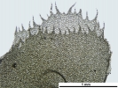 Plagiochila heterophylla
