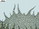 Plagiochila heterophylla