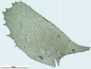Plagiochila heterophylla