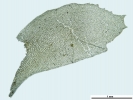 Plagiochila heterophylla