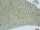 Plagiochila heterophylla