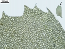 Plagiochila heterophylla