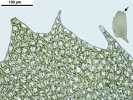Plagiochila heterophylla