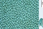 Plagiochila heterophylla