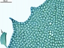 Plagiochila heterophylla