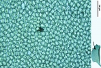 Plagiochila heterophylla