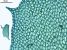 Plagiochila heterophylla