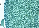 Plagiochila heterophylla