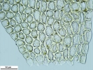 Plagiochila exigua