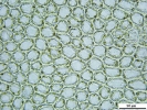 Plagiochila exigua