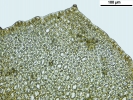 Marsupella aquatica