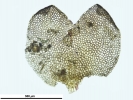Marsupella sparsifolia
