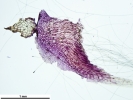 Marchantia chenopoda