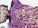 Marchantia chenopoda