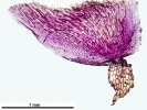 Marchantia chenopoda