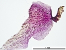 Marchantia chenopoda