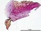 Marchantia chenopoda