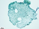 Marchantia chenopoda