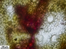 Marchantia chenopoda