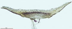 Marchantia chenopoda