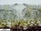 Marchantia chenopoda