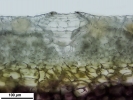 Marchantia chenopoda