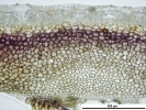 Marchantia chenopoda