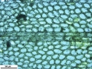 Metzgeria albinea var. albinea