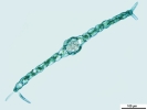 Metzgeria albinea var. albinea