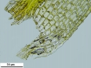 Philonotis elongata