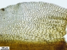 Pogonatum tortile