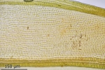 Schistidium trichodon