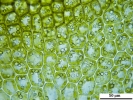 Gymnocolea inflata subsp. inflata