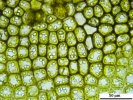 Gymnocolea inflata subsp. inflata