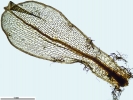 Rhizomnium appalachianum