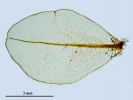 Rhizomnium appalachianum