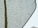 Rhizomnium appalachianum